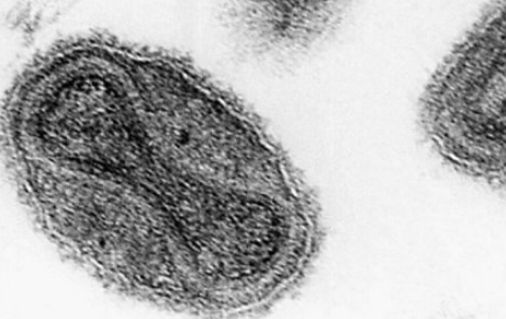保留天花病毒样本的重要性