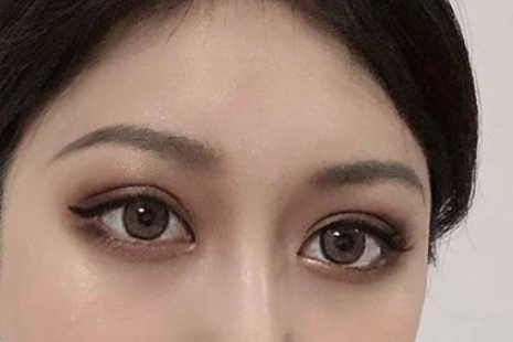 双眼皮有后长的吗？分别有几个方面的可能？