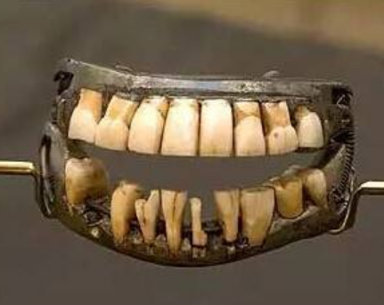 古代人如何弥补缺失的牙齿：探索古代假牙的材料与制作