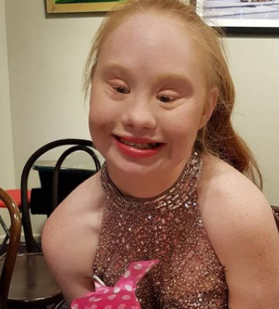 Unraveling the awareness of Down syndrome behind 