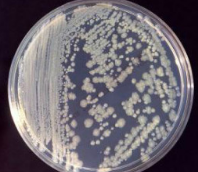 巴斯德的微生物学贡献：开辟现代医学新纪元