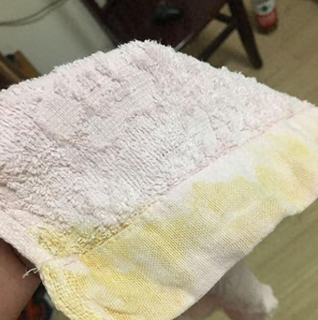 毛巾异味大作战：科学去味与日常护理全攻略