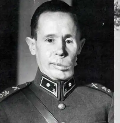 西蒙海耶的脸为什么是歪的？外脸的原因是什么？