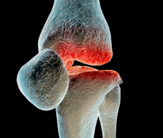 人体最大的籽骨是膝盖骨吗？为什么这么说？